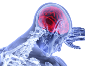 Brain-inflammation_pixabay