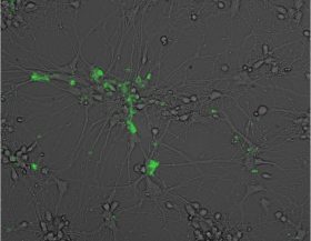 EBVInfectedNeuron