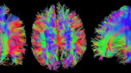 Hersenen-MRI_pixabay