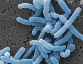 Lactobacillus_Wikimedia