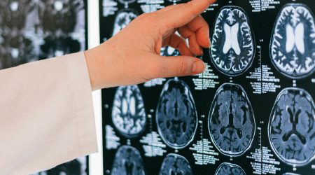 MRI-brein_pexels