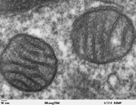 Mitochondria_mammalian_lung