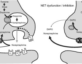 NETdeficiency