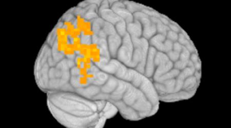 Nath_MECFS_brain-fMRI