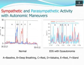 Sympatethic_ParasympatethicActivity