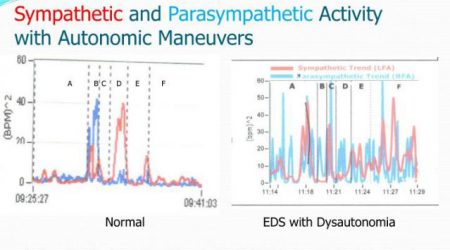 Sympatethic_ParasympatethicActivity